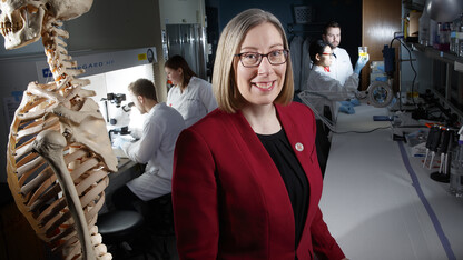 Rebecca Wachs, assistant professor of biological systems engineering, earned a National Science Foundation CAREER award to support her development of a non-opioid treatment of back pain
