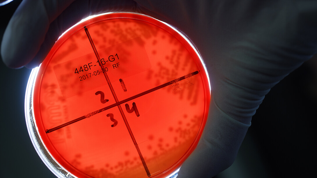 A Nebraska student examines E.coli bacteria growing in a petri dish as part of a research project led by Rodney Moxley, professor of veterinary medicine and biomedical sciences.