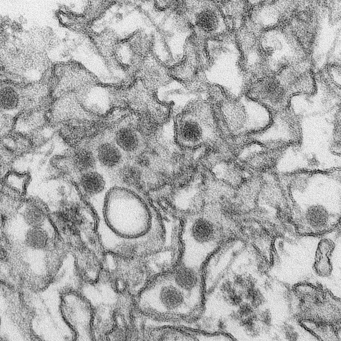A transmission electron micrograph of Zika virus. Virus particles are 40 nm in diameter with an outer envelope and an inner dense core.