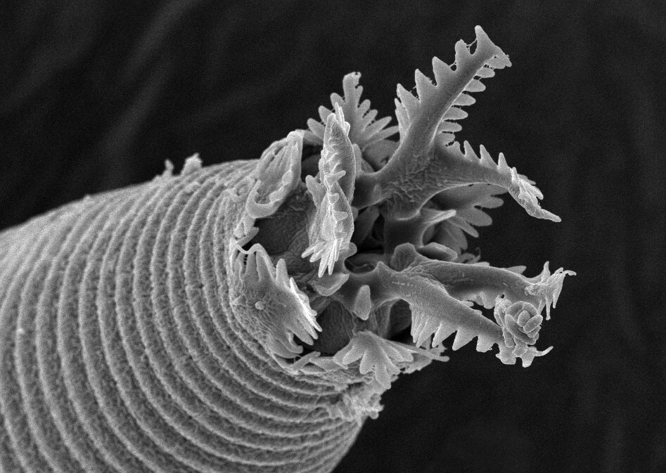 Pictured- the head of an Acrobeles nematode, as photographed using scanning electron microscopy at approximately 5,000x magnification. This nematode is found in soil from many Nebraskan prairie sites.